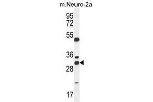Image no. 1 for anti-ARV1 Homolog (ARV1) (AA 30-59), (N-Term) antibody (ABIN950524)