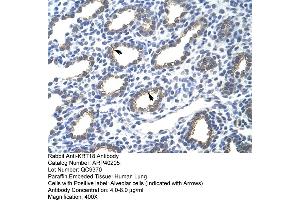 Image no. 2 for anti-Keratin 18 (KRT18) (N-Term) antibody (ABIN2778669)