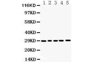 Image no. 1 for anti-Anterior Pharynx Defective 1 Homolog A (C. Elegans) (APH1A) (AA 236-265), (C-Term) antibody (ABIN3043504)