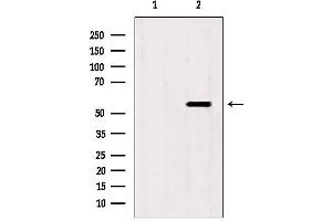 Image no. 1 for anti-Src Kinase Associated Phosphoprotein 2 (SKAP2) (C-Term) antibody (ABIN6265100)