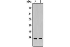 Image no. 1 for anti-KCNE1-Like (KCNE1L) (Center) antibody (ABIN2706437)
