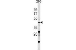 Image no. 1 for anti-Visual System Homeobox 2 (VSX2) (AA 262-291), (C-Term) antibody (ABIN955534)