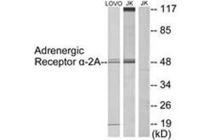 ADRA2A anticorps  (AA 331-380)