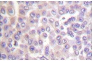 Image no. 1 for anti-Phospholipase A2, Group IVB (Cytosolic) (PLA2G4B) antibody (ABIN271921)