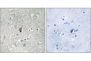 Image no. 1 for anti-Anaphase Promoting Complex Subunit 1 (ANAPC1) (AA 321-370), (pSer355) antibody (ABIN1532106)