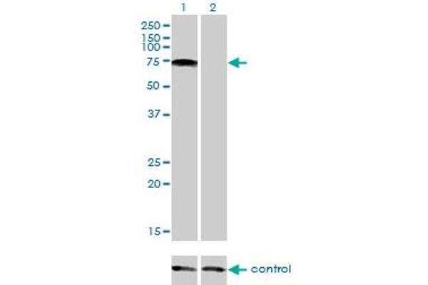 anti-Protein Inhibitor of Activated STAT, 2 (PIAS2) (AA 385-473) antibody