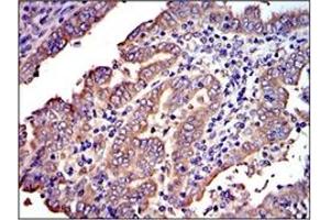 Image no. 4 for anti-V-Crk Sarcoma Virus CT10 Oncogene Homolog (Avian) (CRK) antibody (ABIN1106835)