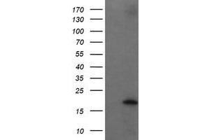 Image no. 10 for anti-Ubiquitin-Conjugating Enzyme E2G 2 (UBE2G2) antibody (ABIN1501634)