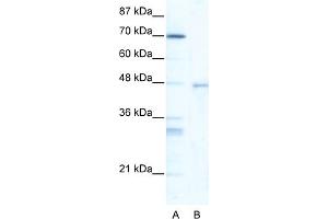 Image no. 1 for anti-Heat Shock Transcription Factor 4 (HSF4) (Middle Region) antibody (ABIN2779779)