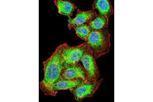 Image no. 6 for anti-V-Akt Murine Thymoma Viral Oncogene Homolog 1 (AKT1) (AA 1-150) antibody (ABIN5542263)