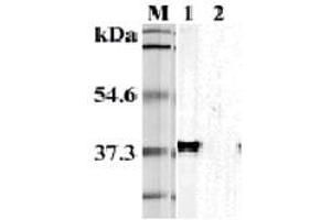 Image no. 1 for anti-Hepatitis A Virus Cellular Receptor 2 (TIM 3) antibody (ABIN1169015)
