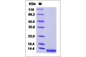 Image no. 1 for Chemokine (C-C Motif) Ligand 8 (CCL8) (AA 24-99) protein (His tag) (ABIN5499792)