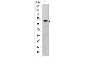 Image no. 1 for anti-FYN Oncogene Related To SRC, FGR, YES (FYN) antibody (ABIN1107284)