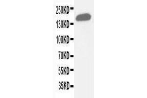 Anti-Gli2 antibody, Western blotting WB: Human Placenta Tissue Lysate