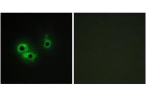 Image no. 2 for anti-Anterior Gradient 3 (AGR3) (AA 1-50) antibody (ABIN1534020)