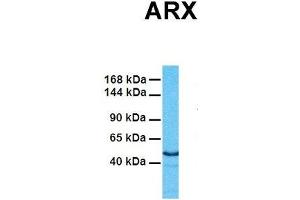 Image no. 2 for anti-Aristaless Related Homeobox (ARX) (Middle Region) antibody (ABIN2779819)
