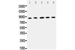 Image no. 3 for anti-Intercellular Adhesion Molecule 1 (ICAM1) (AA 198-537) antibody (ABIN3042515)