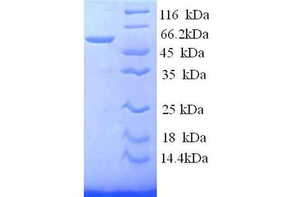 SAG Protein (AA 1-405, full length) (His tag)