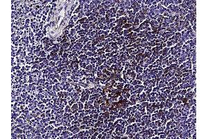 Image no. 2 for anti-Fc Fragment of IgE, Low Affinity II, Receptor For (CD23) (FCER2) (AA 48-321) antibody (ABIN2649195)