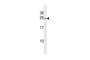 PIGP Antibody (N-term) (ABIN1538804 and ABIN2848500) western blot analysis in T47D cell line lysates (35 μg/lane).