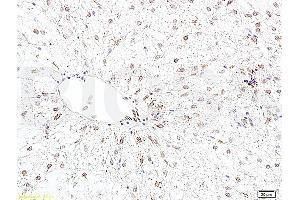 Image no. 1 for anti-B-Cell CLL/lymphoma 2 (BCL2) (AA 101-160) antibody (ABIN723920)