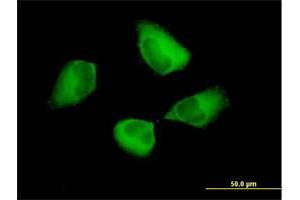 Image no. 5 for anti-Programmed Cell Death 6 Interacting Protein (PDCD6IP) (AA 1-868) antibody (ABIN523392)
