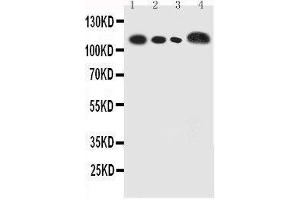 Image no. 2 for anti-Carcinoembryonic Antigen-Related Cell Adhesion Molecule 5 (CEACAM5) (full length) antibody (ABIN3042800)