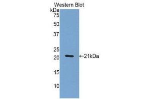 Image no. 1 for anti-Orosomucoid 1 (ORM1) (AA 20-186) antibody (ABIN1077770)