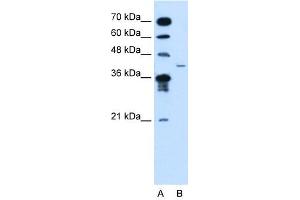 Image no. 1 for anti-Microfibrillar-Associated Protein 3-Like (MFAP3L) (N-Term) antibody (ABIN630299)