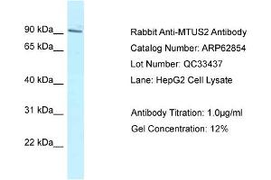 Image no. 1 for anti-Microtubule-associated Tumor Suppressor Candidate 2 (MTUS2) (C-Term) antibody (ABIN2789269)