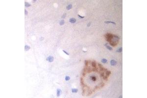 Image no. 5 for anti-Solute Carrier Family 18 (Vesicular Acetylcholine), Member 3 (SLC18A3) (Internal Region) antibody (ABIN571639)