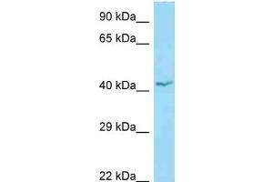 Image no. 2 for anti-Apolipoprotein L, 1 (APOL1) (N-Term) antibody (ABIN2787851)