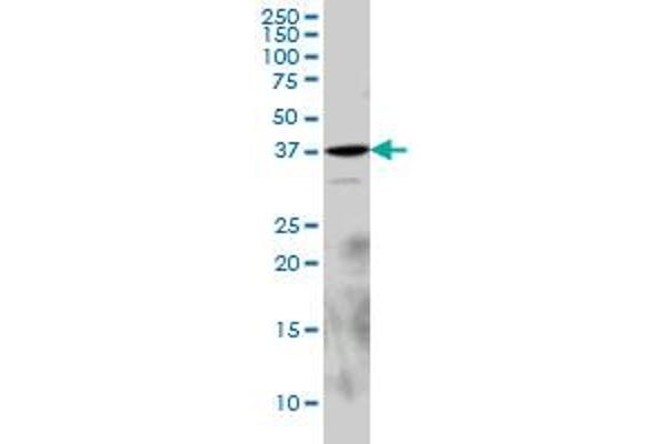 EPM2A antibody  (AA 101-199)
