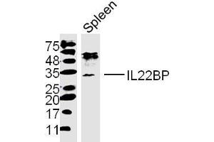 IL22RA2 antibody  (AA 165-263)