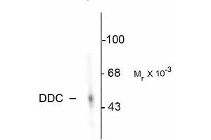 Image no. 1 for anti-Dopa Decarboxylase (Aromatic L-Amino Acid Decarboxylase) (DDC) antibody (ABIN361424)