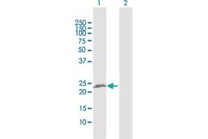 Western Blot analysis of RTN3 expression in transfected 293T cell line by RTN3 MaxPab polyclonal antibody.