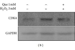 Image no. 16 for anti-Glyceraldehyde-3-Phosphate Dehydrogenase (GAPDH) (Center) antibody (ABIN2857072)