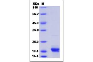 Image no. 1 for Mdm4-binding Protein (MDM4) (AA 1-134) protein (His tag) (ABIN2006500)