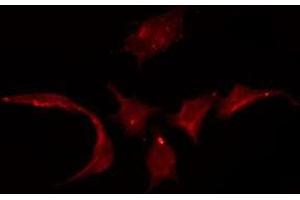 Image no. 1 for anti-Organic Cation Transporter 3 (OCT3) antibody (ABIN6258632)