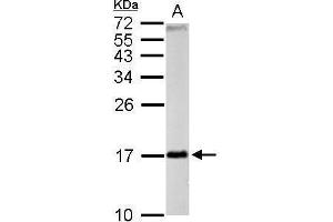 Image no. 7 for anti-Fission 1 (FIS1) (full length) antibody (ABIN2856782)