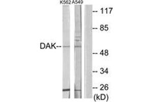 Image no. 1 for anti-Dihydroxyacetone Kinase 2 Homolog (DAK) (AA 91-140) antibody (ABIN1533941)