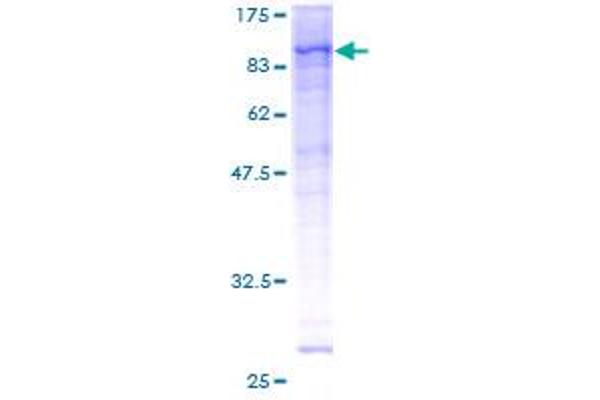 RPS6KA1 Protein (AA 1-735) (GST tag)