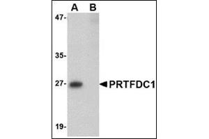 Image no. 1 for anti-phosphoribosyl Transferase Domain Containing 1 (PRTFDC1) (Center) antibody (ABIN500545)