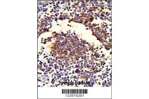 Image no. 2 for anti-Complement Component C7 (C7) antibody (ABIN2158003)