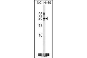 Image no. 1 for anti-Protein Phosphatase 1, Regulatory (Inhibitor) Subunit 2 (PPP1R2) (AA 49-77) antibody (ABIN1881680)