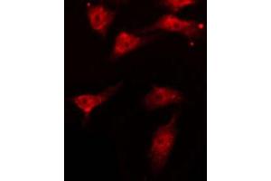 Image no. 5 for anti-V-Akt Murine Thymoma Viral Oncogene Homolog 1 (AKT1) (pThr450) antibody (ABIN6256564)