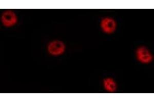 Image no. 2 for anti-Transcription Factor 7 (T-Cell Specific, HMG-Box) (TCF7) antibody (ABIN6266277)