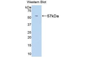Fibrinogen beta Chain anticorps  (AA 33-479)