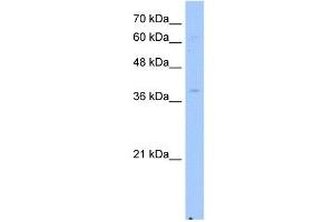 Image no. 1 for anti-NAD(P) Dependent Steroid Dehydrogenase-Like (NSDHL) antibody (ABIN630356)