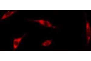 Image no. 4 for anti-erythrocyte Membrane Protein Band 4.9 (Dematin) (EPB49) (pSer403) antibody (ABIN6255309)